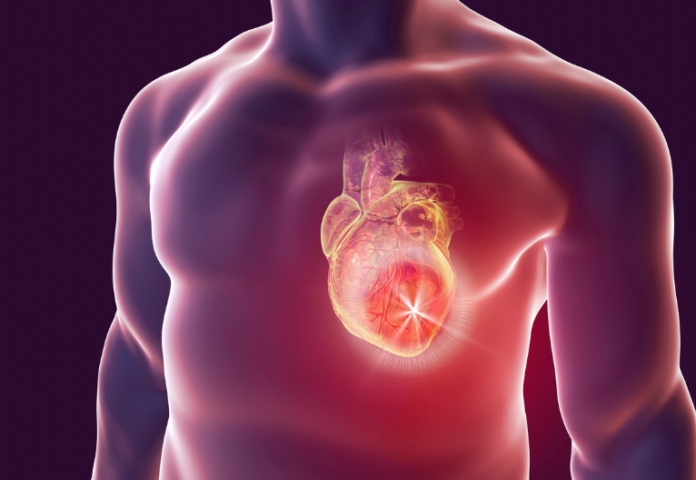 Graphic of a man's torso showing location of the heart.