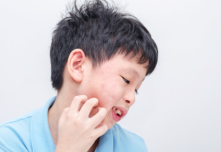 Child scratching his face.