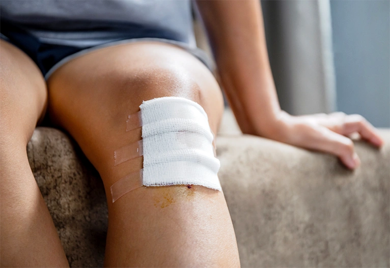 Child with a grazed knee.